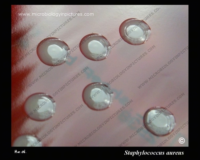 s.aureus convex colonies